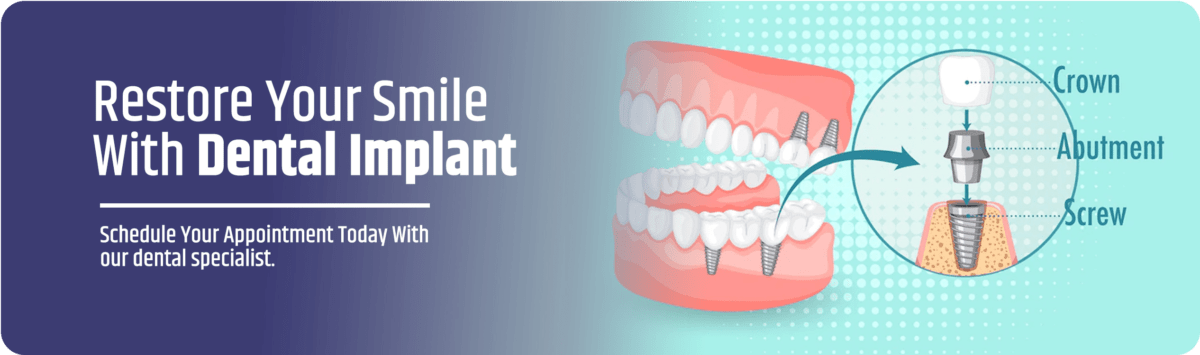dental-implant-home-banner-png-min-e1654497951884-min